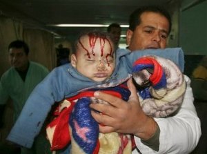APTOPIX MIDEAST ISRAEL PALESTINIANS အစၥေရးစစ္တပ္၏တ�ုက္ခ�ုက္မွဳေၾကာင့္ဒဏ္ရာရသြားေသာပါလစတ�ုင္းကေလးငယ္